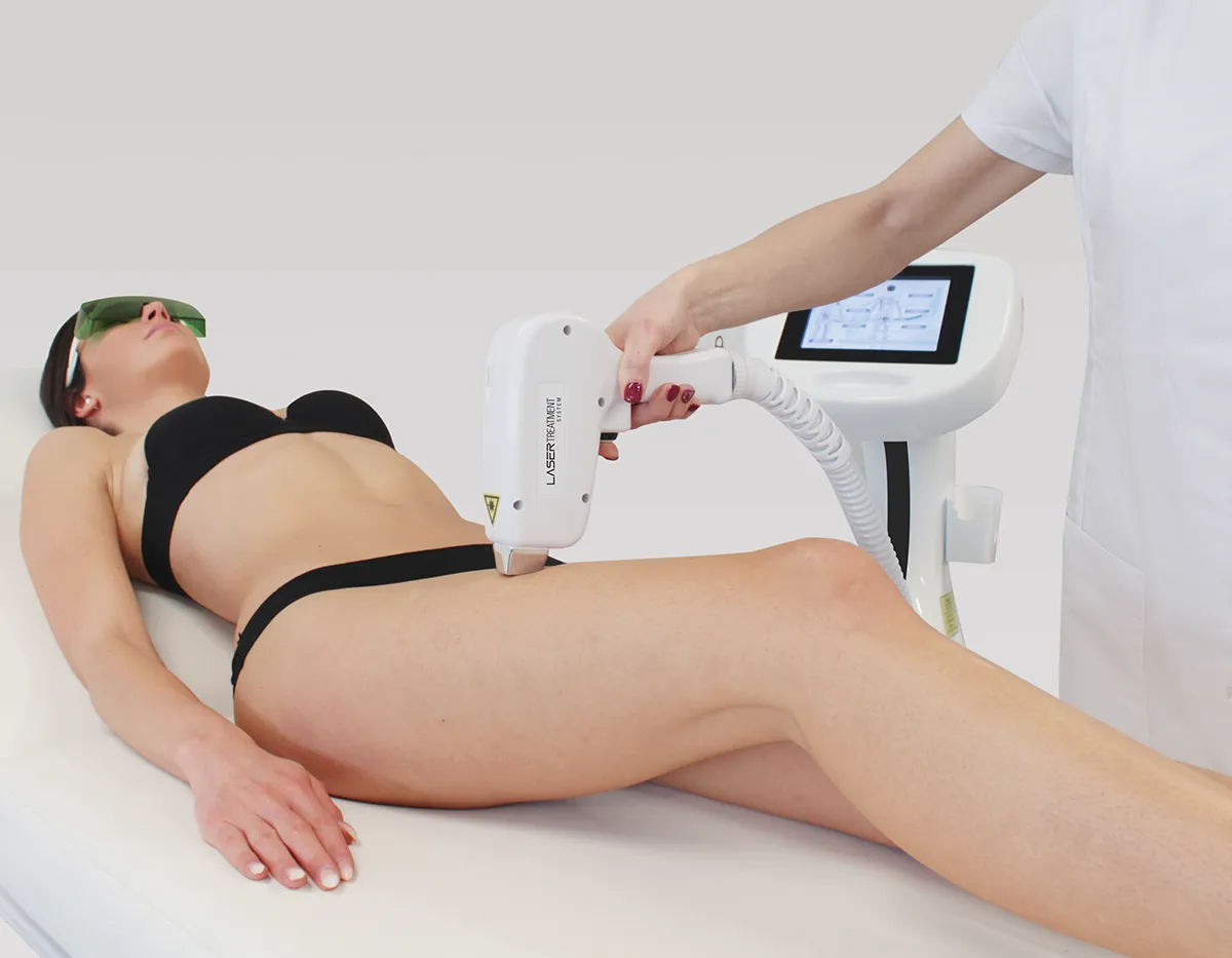 Epilazione Laser
